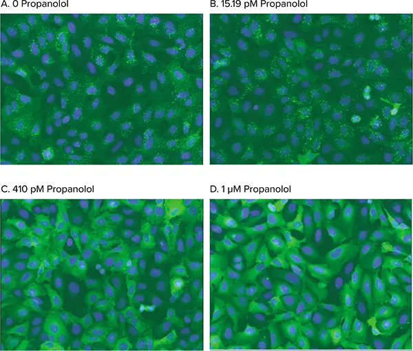 図5. 小胞形成のアゴニスト刺激。尾部修飾 ß2AR の刺激によるアレス チン-GFP 転移の用量依存的阻害の分析像。セルを 0 (A), 15.19 pM (B), 410 pM (C), または 1 µM (D) プロパノールで処理し、50 nM イソプロテレノールで刺激した。Transfluor Assay Application Moduleは、アンタゴニスト阻害によってブロックされた小胞形成を正確に同定した。