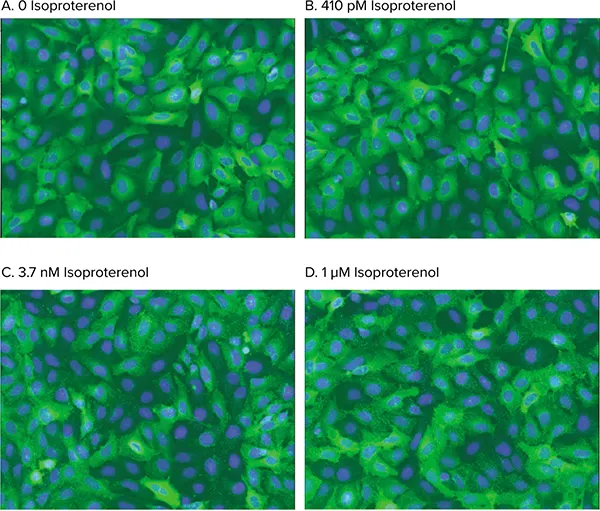 図4. ピット形成のアゴニスト刺激。WTß2AR の活性化に伴う用量依存的 ß-arrestin-GFP 転移の解析画像。セルは 0 (A), 410 pM (B), 3.7 nM (C), または 1 µM (D) イソプロテレノールで処理した。Transfluor Assay Application Moduleにより、アゴニスト刺激によるピット形成が正確に同定された。